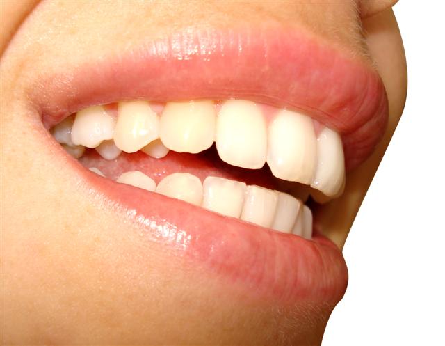 מתי צריכים טיפולי שיניים כולל השתלות